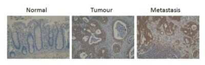Immunohistochemistry: Cytochrome P450 26B1 Antibody (T5P3G2*A3) - BSA Free [NBP2-50195]