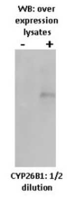 Western Blot: Cytochrome P450 26B1 Antibody (T5P3G2*A3)BSA Free [NBP2-50195]