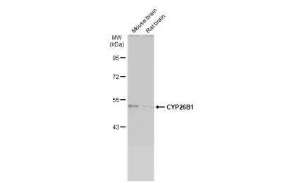 Western Blot: Cytochrome P450 26B1 Antibody [NBP1-33476]