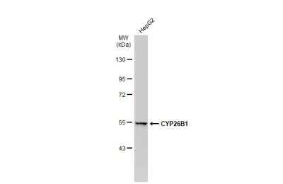 Western Blot: Cytochrome P450 26B1 Antibody [NBP1-33476]