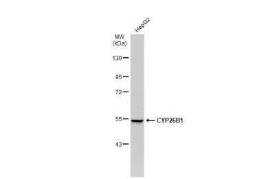 Western Blot: Cytochrome P450 26B1 Antibody [NBP1-33476]