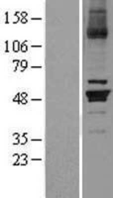 Western Blot: Cytochrome P450 26B1 Overexpression Lysate [NBL1-09680]