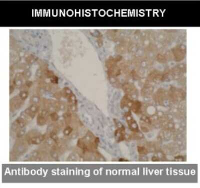 Immunohistochemistry: Cytochrome P450 2A6, 2A7, 2A13 Antibody (F16 P2 D8) - BSA Free [NBP2-50184]