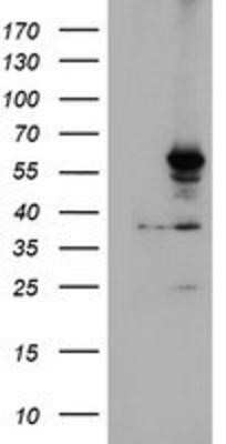 Western Blot: Cytochrome P450 2A6 Antibody (OTI1D2)Azide and BSA Free [NBP2-70524]