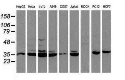 Western Blot: Cytochrome P450 2A6 Antibody (OTI1D2) [NBP2-01437]