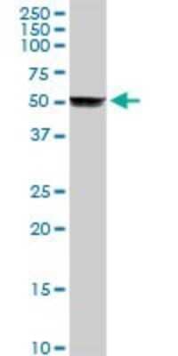 Western Blot: Cytochrome P450 2A6 Antibody [H00001548-D01P]