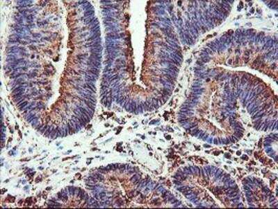 Immunohistochemistry-Paraffin: Cytochrome P450 2B6 Antibody (OTI3D5) [NBP2-01800]