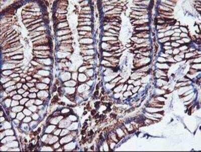 Immunohistochemistry-Paraffin: Cytochrome P450 2B6 Antibody (OTI3D5) [NBP2-01800]