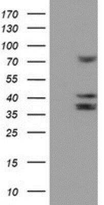 Western Blot: Cytochrome P450 2B6 Antibody (OTI3D5) [NBP2-01800]