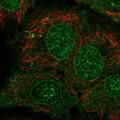 Immunocytochemistry/ Immunofluorescence: Cytochrome P450 2B6 Antibody [NBP2-57140]