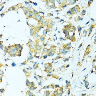 Immunohistochemistry-Paraffin: Cytochrome P450 2B6 Antibody - BSA Free [NBP2-92746]