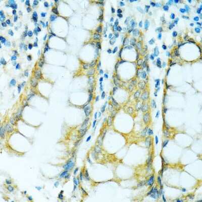 Immunohistochemistry-Paraffin: Cytochrome P450 2B6 Antibody - BSA Free [NBP2-92746]
