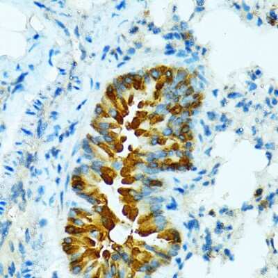 Immunohistochemistry-Paraffin: Cytochrome P450 2B6 Antibody - BSA Free [NBP2-92746]