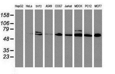 Western Blot: Cytochrome P450 2B6 Antibody (OTI3D5)Azide and BSA Free [NBP2-70526]