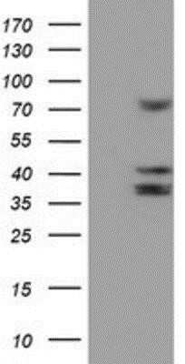 Western Blot: Cytochrome P450 2B6 Antibody (OTI3D5)Azide and BSA Free [NBP2-70526]