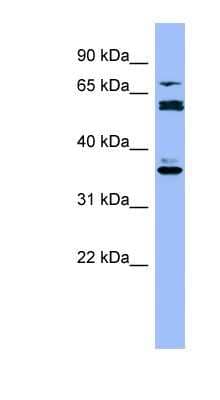 Western Blot: Cytochrome P450 2B6 Antibody [NBP1-57978]