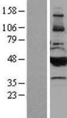 Western Blot: Cytochrome P450 2B6 Overexpression Lysate [NBP2-04177]