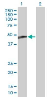 Western Blot: Cytochrome P450 2C18 Antibody [H00001562-B01P]