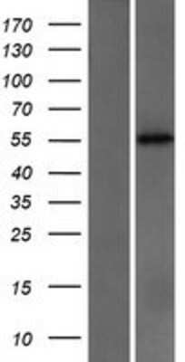 Western Blot: Cytochrome P450 2C18 Overexpression Lysate [NBP2-10705]