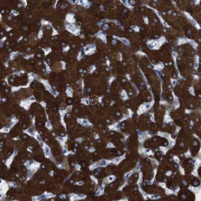 Immunohistochemistry-Paraffin: Cytochrome P450 2C9 Antibody [NBP1-85488]