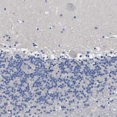 Immunohistochemistry-Paraffin: Cytochrome P450 2C8 Antibody [NBP1-88054]
