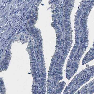 Immunohistochemistry-Paraffin: Cytochrome P450 2C8 Antibody [NBP1-88054]