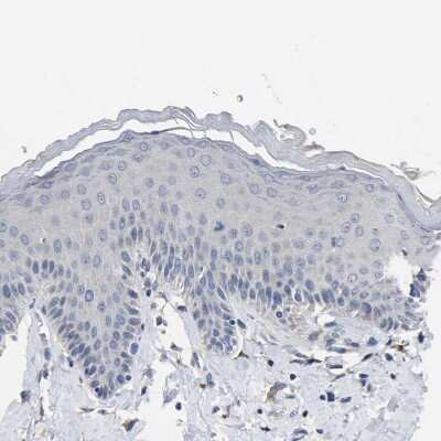 Immunohistochemistry-Paraffin: Cytochrome P450 2C8 Antibody [NBP1-88054]
