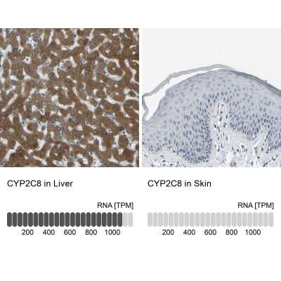 Immunohistochemistry-Paraffin: Cytochrome P450 2C8 Antibody [NBP1-88055]