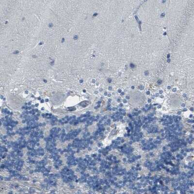 Immunohistochemistry-Paraffin: Cytochrome P450 2C8 Antibody [NBP1-88055]