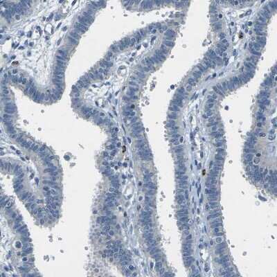 Immunohistochemistry-Paraffin: Cytochrome P450 2C8 Antibody [NBP1-88055]