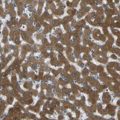 Immunohistochemistry-Paraffin: Cytochrome P450 2C8 Antibody [NBP1-88055]