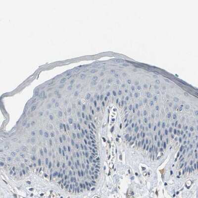 Immunohistochemistry-Paraffin: Cytochrome P450 2C8 Antibody [NBP1-88055]