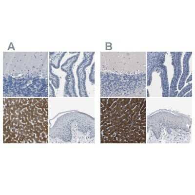 Immunohistochemistry-Paraffin: Cytochrome P450 2C8 Antibody [NBP1-88055]