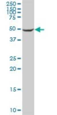 Western Blot: Cytochrome P450 2C8 Antibody [H00001558-B01P]