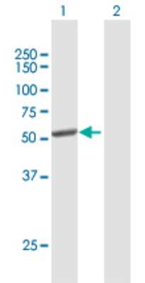 Western Blot: Cytochrome P450 2C8 Antibody [H00001558-B01P]