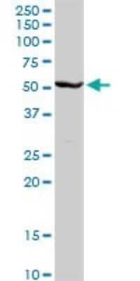 Western Blot: Cytochrome P450 2C8 Antibody [H00001558-D01P]