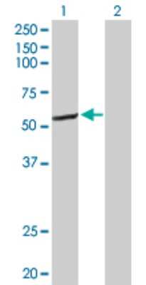 Western Blot: Cytochrome P450 2C8 Antibody [H00001558-D01P]