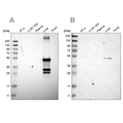 Western Blot: Cytochrome P450 2C8 Antibody [NBP1-88054]