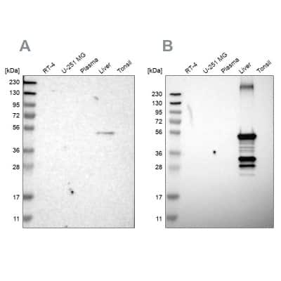 Western Blot: Cytochrome P450 2C8 Antibody [NBP1-88055]