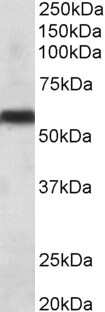 Western Blot: Cytochrome P450 2C8 Antibody [NBP1-97759]