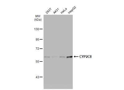 Western Blot: Cytochrome P450 2C8 Antibody [NBP2-16078]