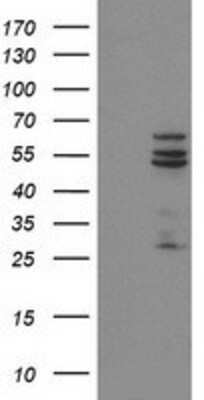 Western Blot: Cytochrome P450 2C9 Antibody (OTI1D7) [NBP2-01397]