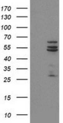 Western Blot: Cytochrome P450 2C9 Antibody (OTI1D7)Azide and BSA Free [NBP2-70528]