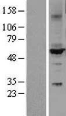 Western Blot: Cytochrome P450 2C9 Overexpression Lysate [NBL1-09686]