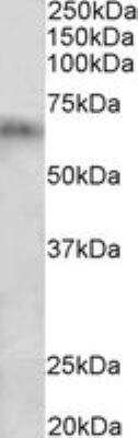 Western Blot: Cytochrome P450 2D10 Antibody [NBP2-29340]