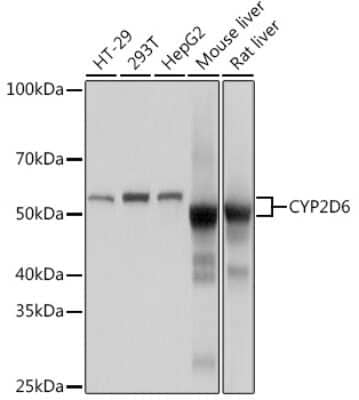 Western Blot: Cytochrome P450 2D6 Antibody (1X3F0) [NBP3-16610]