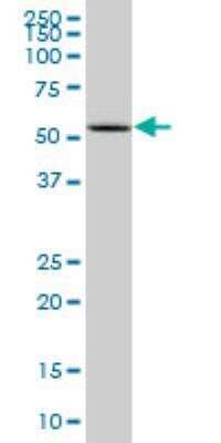 Western Blot: Cytochrome P450 2D6 Antibody (2C5) [H00001565-M07]