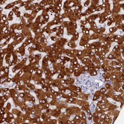 Immunohistochemistry-Paraffin: Cytochrome P450 2D6 Antibody [NBP1-91818]