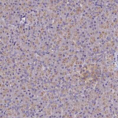 Immunohistochemistry-Paraffin: Cytochrome P450 2D6 Antibody [NBP1-91818]