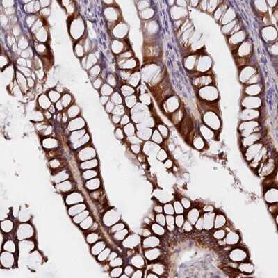 Immunohistochemistry-Paraffin: Cytochrome P450 2D6 Antibody [NBP1-91818]